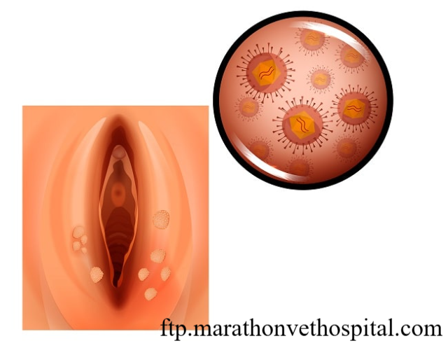 Kenali Radang Vagina dan Alasan Segera Periksa ke Dokter